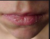 Mojolips Lanolin Lip Cream - 100% pure & Organic | Lip Balm - Mojopanda Organic Store